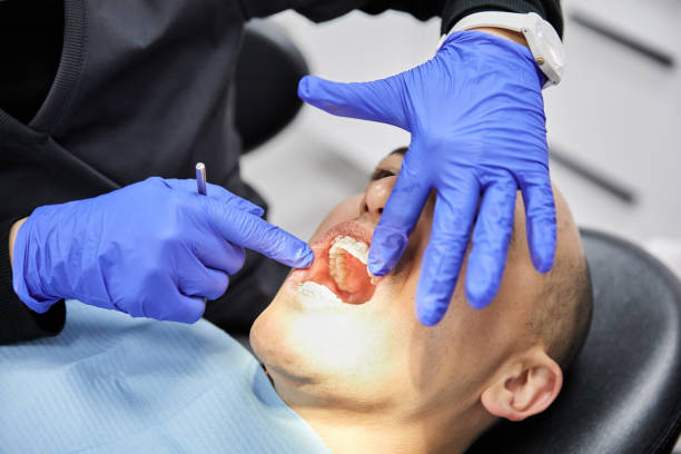 Best Emergency Wisdom Tooth Extraction in North Warren, PA